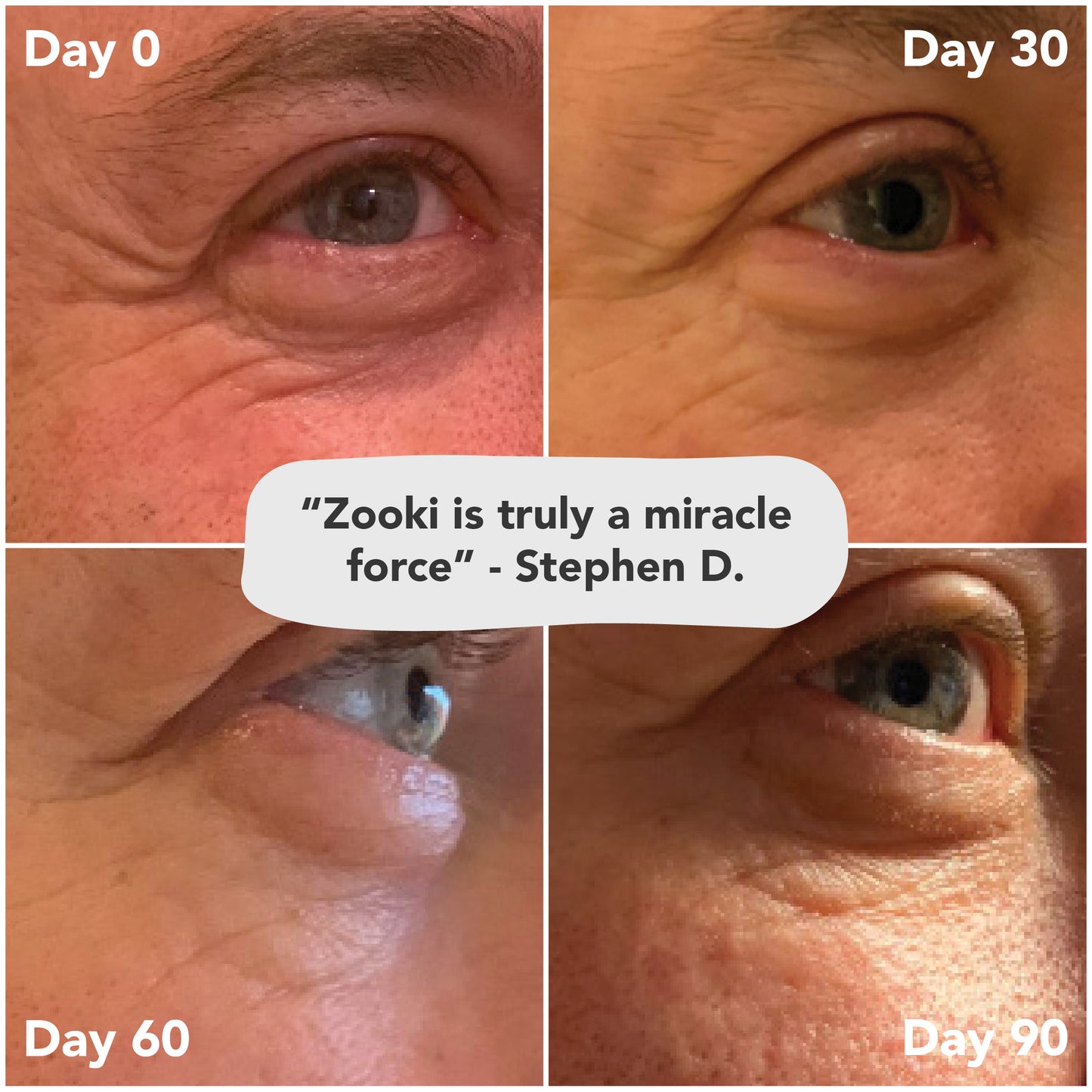 £2.99 Zooki Collagen Liquid Sachets (20)